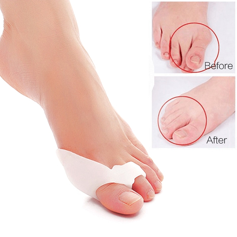 Silicone Bunion Corrector6.jpg